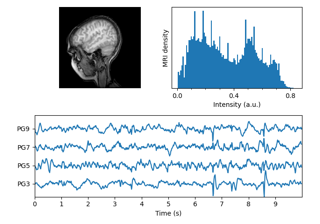 MRI With EEG