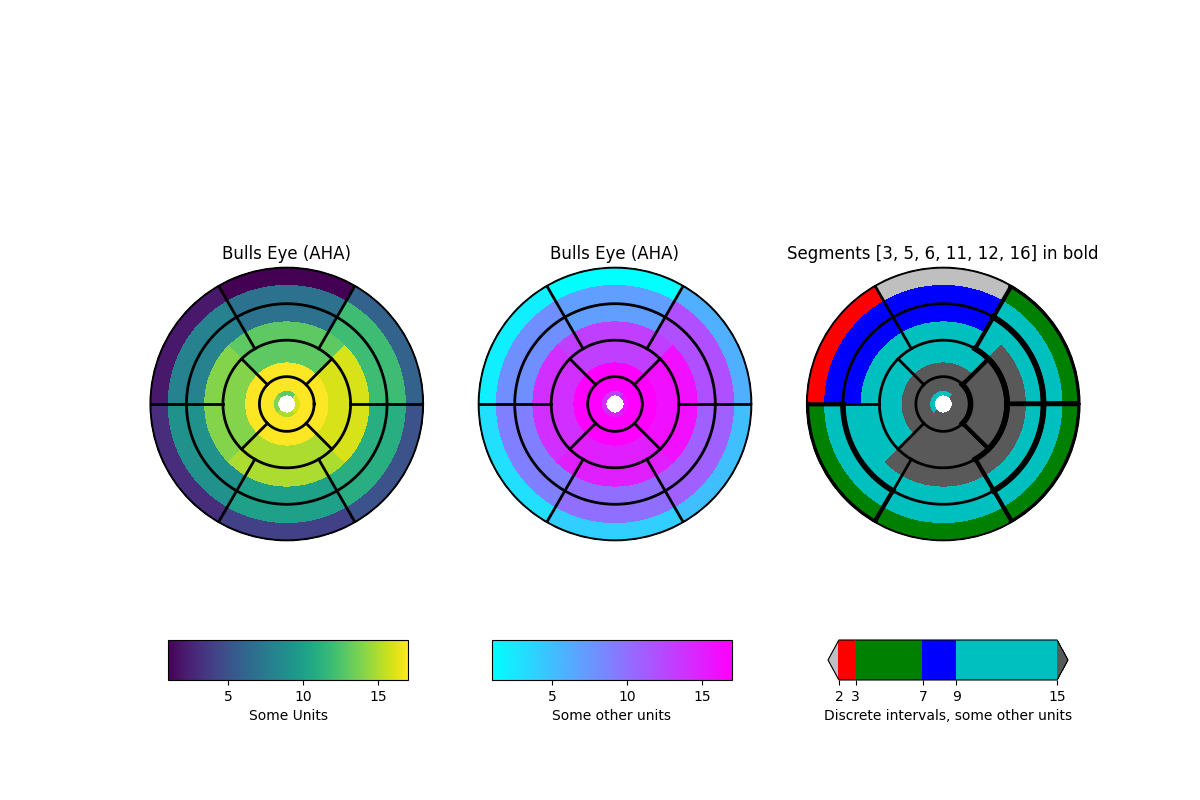 Bulls Eye (AHA), Bulls Eye (AHA), Segments [3, 5, 6, 11, 12, 16] in bold